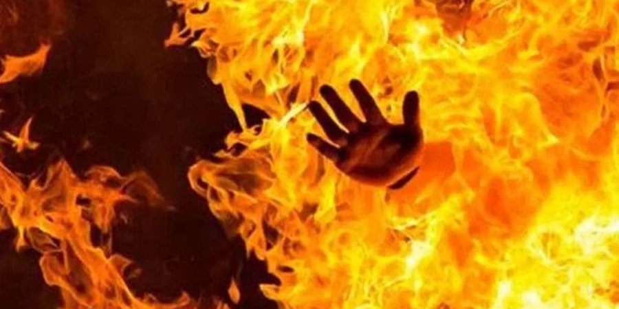 दैब कति निष्ठुरी, सात वर्षिय बालकलाई आगोले जलाएर लगे