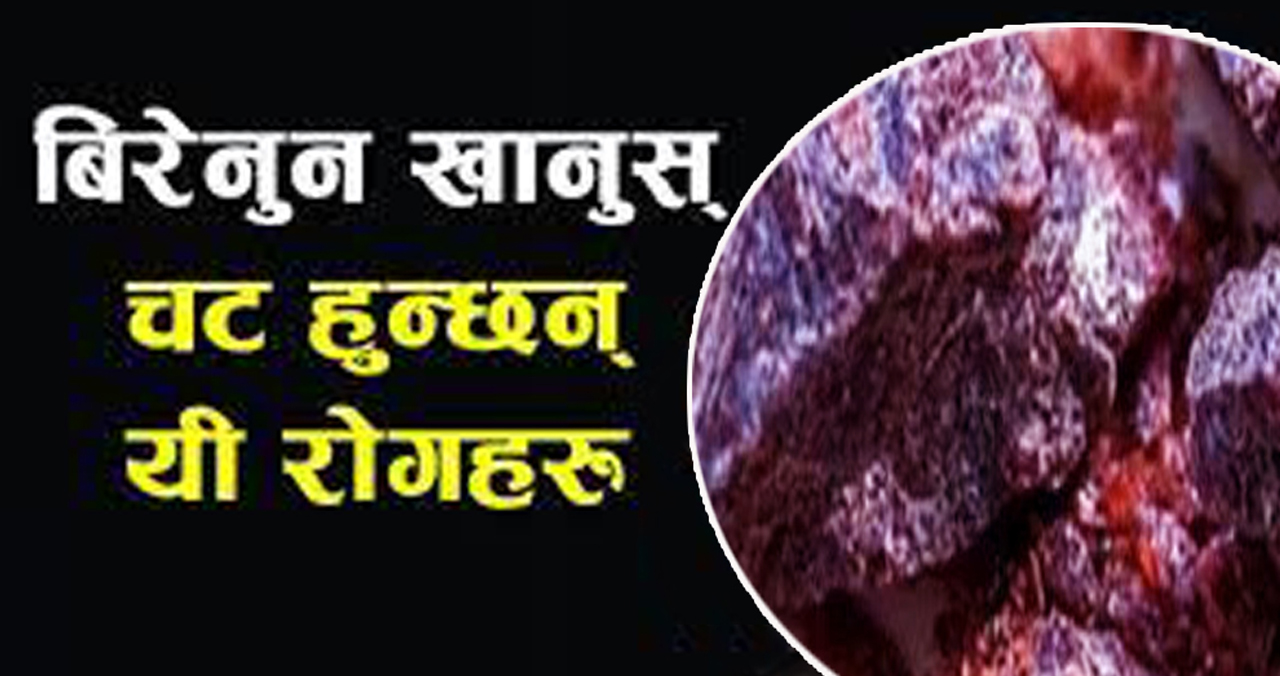 रोगको निवारण बिरेनुनको प्रयोग, यस्ता छन् अमृत सरह बिरेनुनको फाईदा !