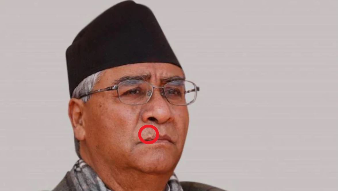 जनताको आक्रमणबाट देउवाको ओठ काटियो, आँखै अगाडी सहकर्मीको हत्या